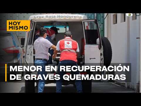 Niña sobreviviente de explosión en Copán muestra mejoría tras sus primeras cirugías