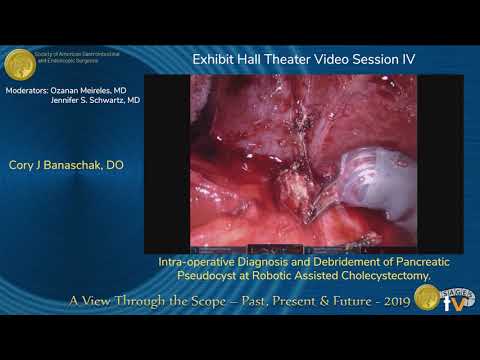 Intra-operative Diagnosis and Debridement of Pancreatic Pseudocyst at Robotic Assisted Cholecystectomy