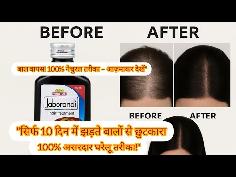 Wheezal Jaborandi Hair Treatment