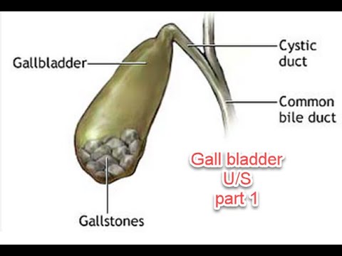 Gall bladder ultrasound part 1 in English  , DR amr salah ( translated by Dr:Dina)