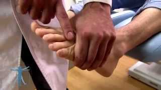 La solución para el Neuroma de Morton