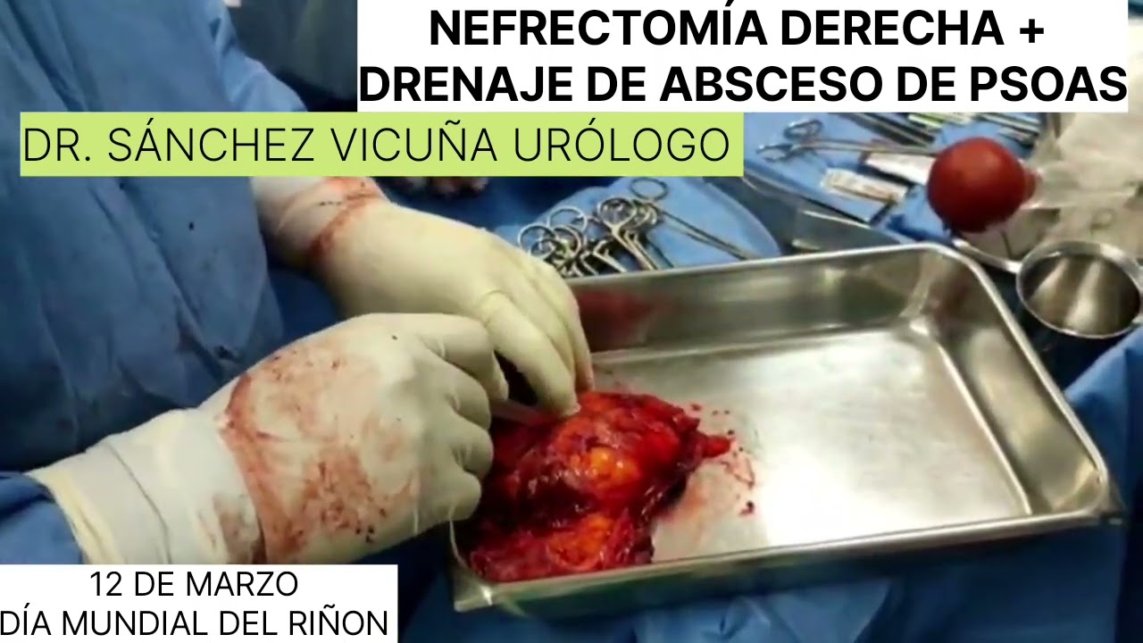 Lázaro Sánchez Vicuña-20