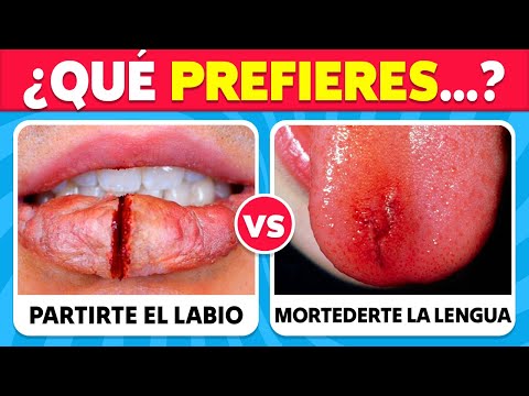 ¿Qué PREFIERES? ¡Las 100 Decisiones MÁS difíciles de Tu Vida! 😱⚠️