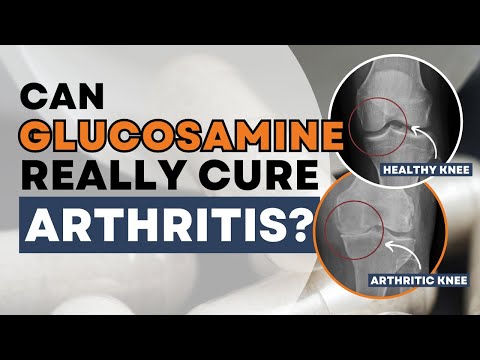 Is Glucosamine Good for Arthritis? What You Need to Know!
