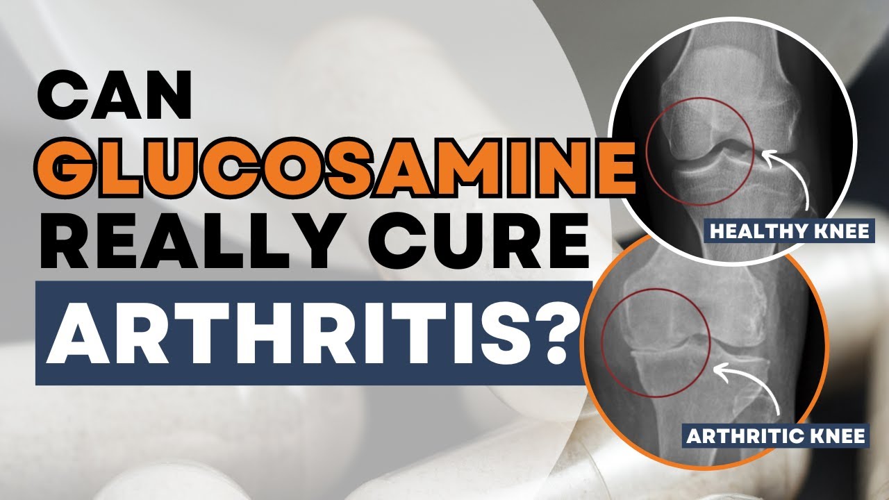 Is Glucosamine Good for Arthritis? What You Need to Know!