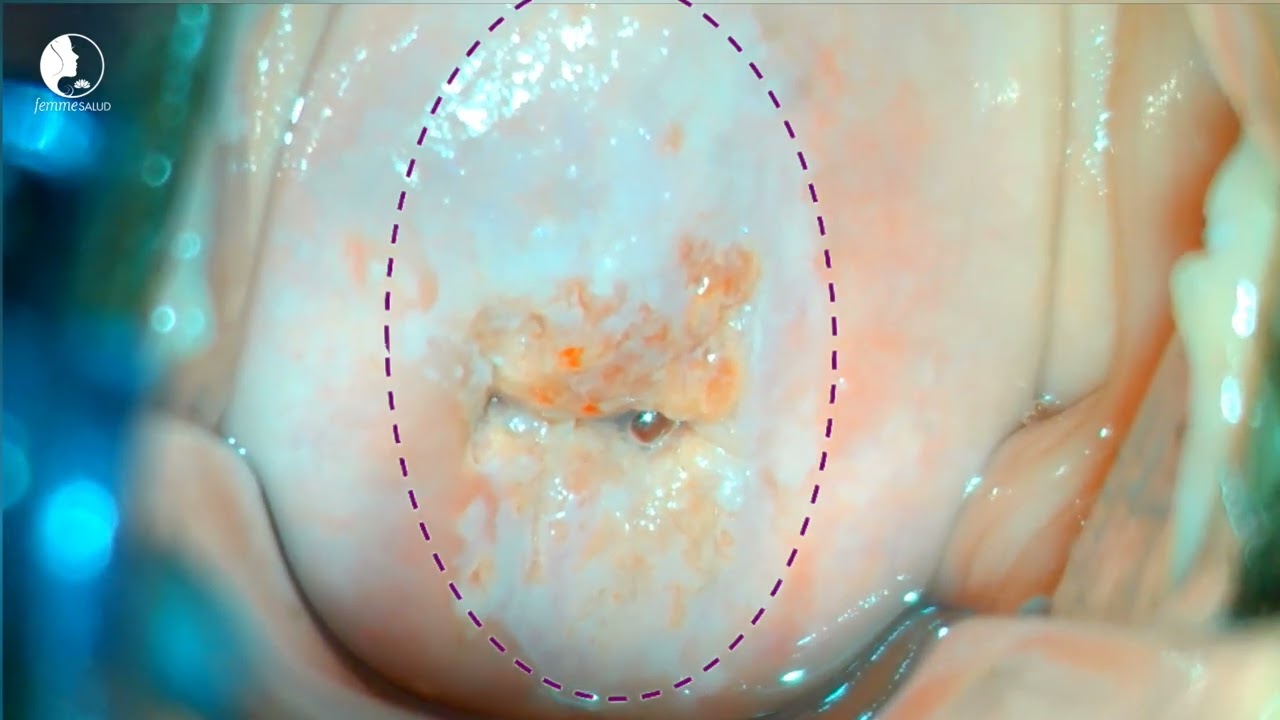 Dante Flores Hernández-33