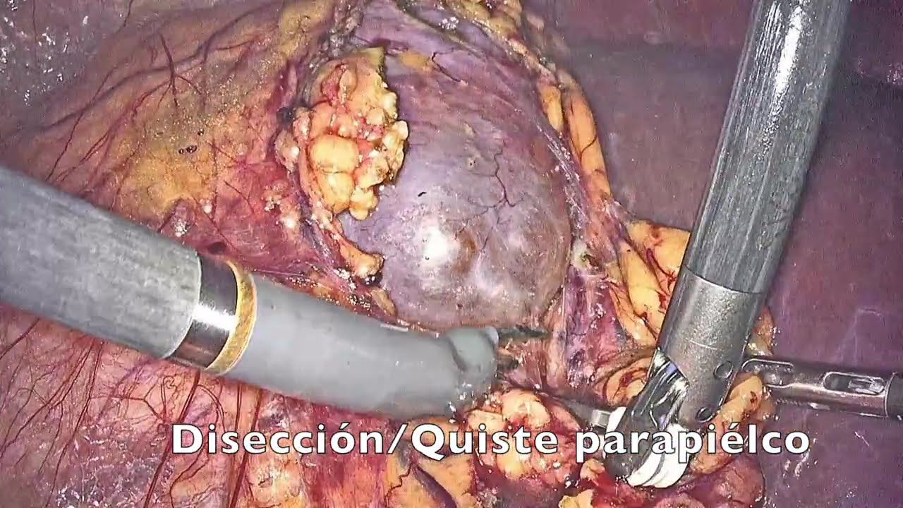 Lenin Rojas Buendía-17