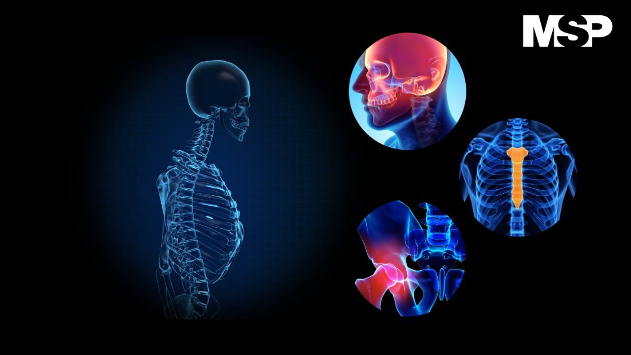 Watch ¿Cómo funciona la quimioterapia y cómo afecta al cuerpo - #ExclusivoMSP Now ¿Cómo funciona la quimioterapia y cómo afecta al cuerpo - #ExclusivoMSP