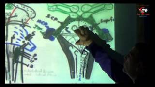 Dr Ahmed Elzainy 4th ventricle Neuroanatomy   الدكتور احمد الزيني