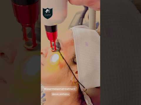 Comprehensive Melasma Treatment