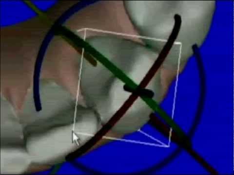 Trattamento dei muscoli della schiena miosite recensioni Mal di schiena spara gamba destra