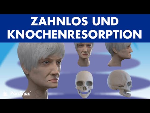 Zahnlos und Knochenresorption ©