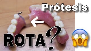 REPARAR PRÓTESIS DENTAL CON MALLA DE REFUERZO PASO A PASO