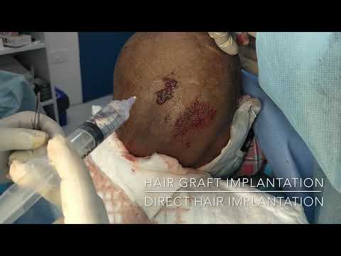 Patient Recovery Case — Video 32 (Clinical Testimonial)