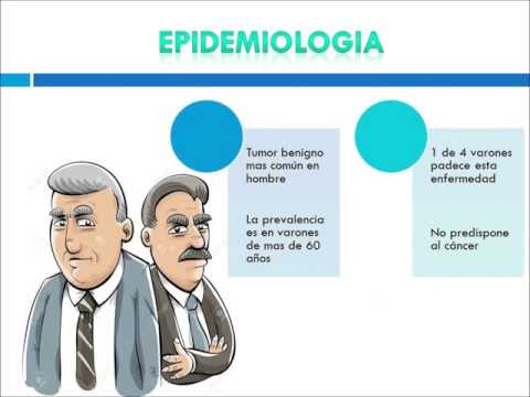 La stimolazione della prostata con la fine Milt apparato di trattamento prostatite