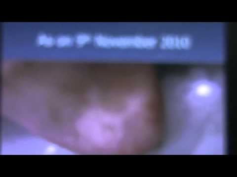 Crema di decolorazione di faccia attiva Se la lentiggine sorride