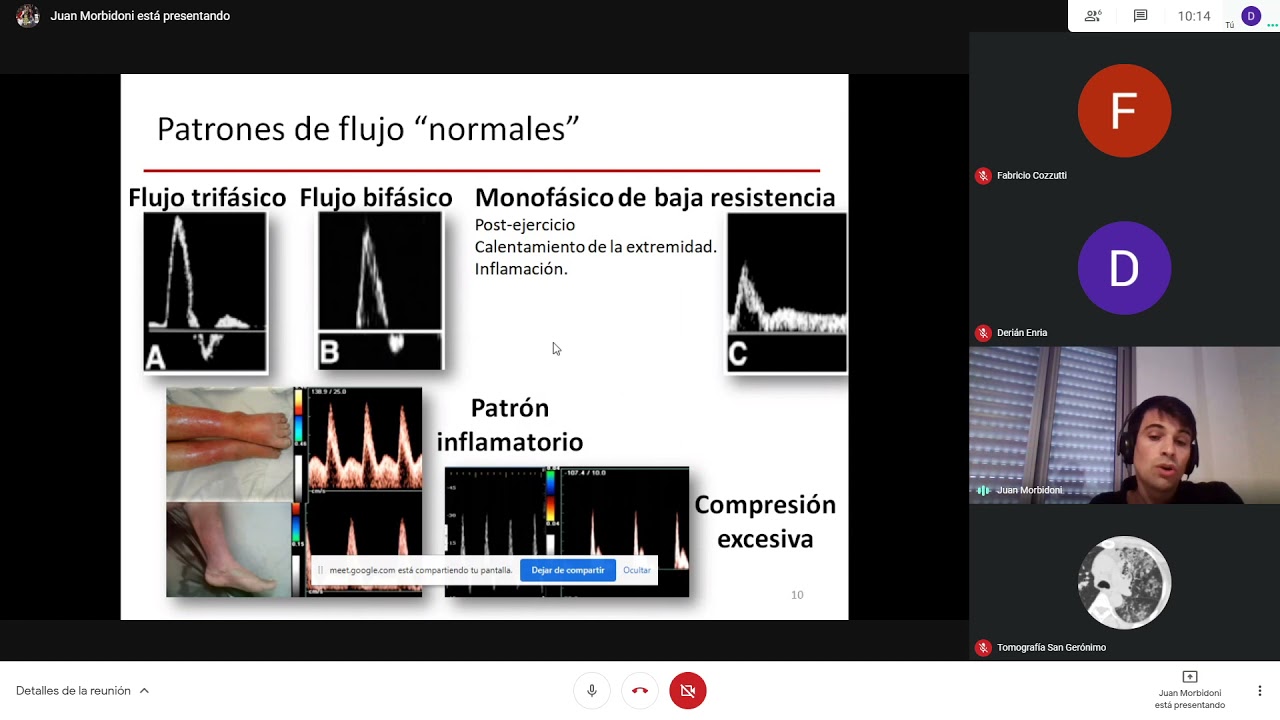 Doppler arterial de miembros inferiores - Juan Morbidoni