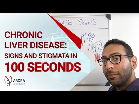 Chronic Liver Disease: Signs and Stigmata in 100 seconds