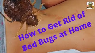 How to Get Rid of Bed Bugs at Home? |  What kills bed bugs instantly? | Home Remedies