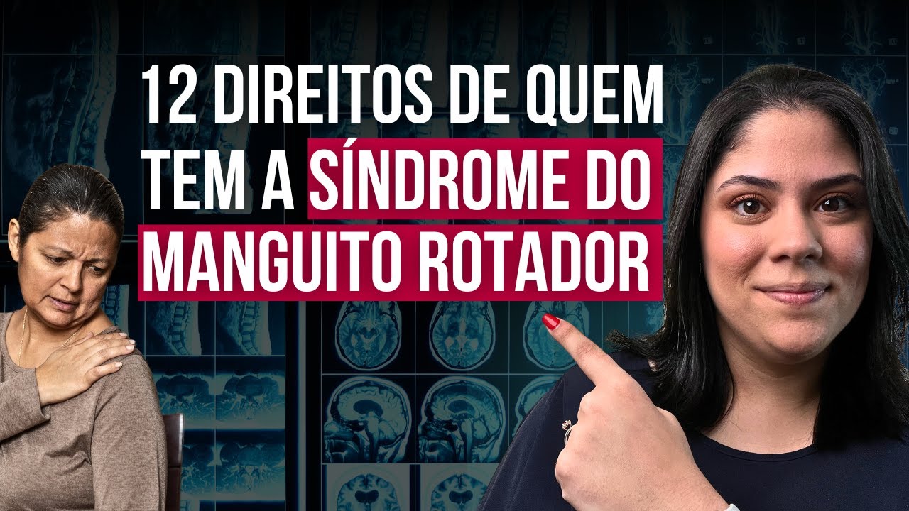12 Direitos de quem tem Síndrome do Manguito Rotador (2024)