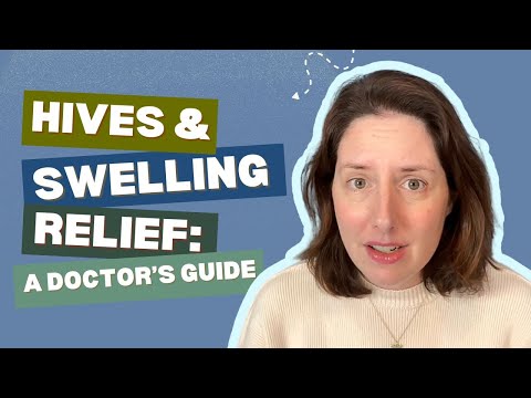 Chronic Hives and Swelling (Urticaria & Angioedema): Causes, Symptoms & Treatment