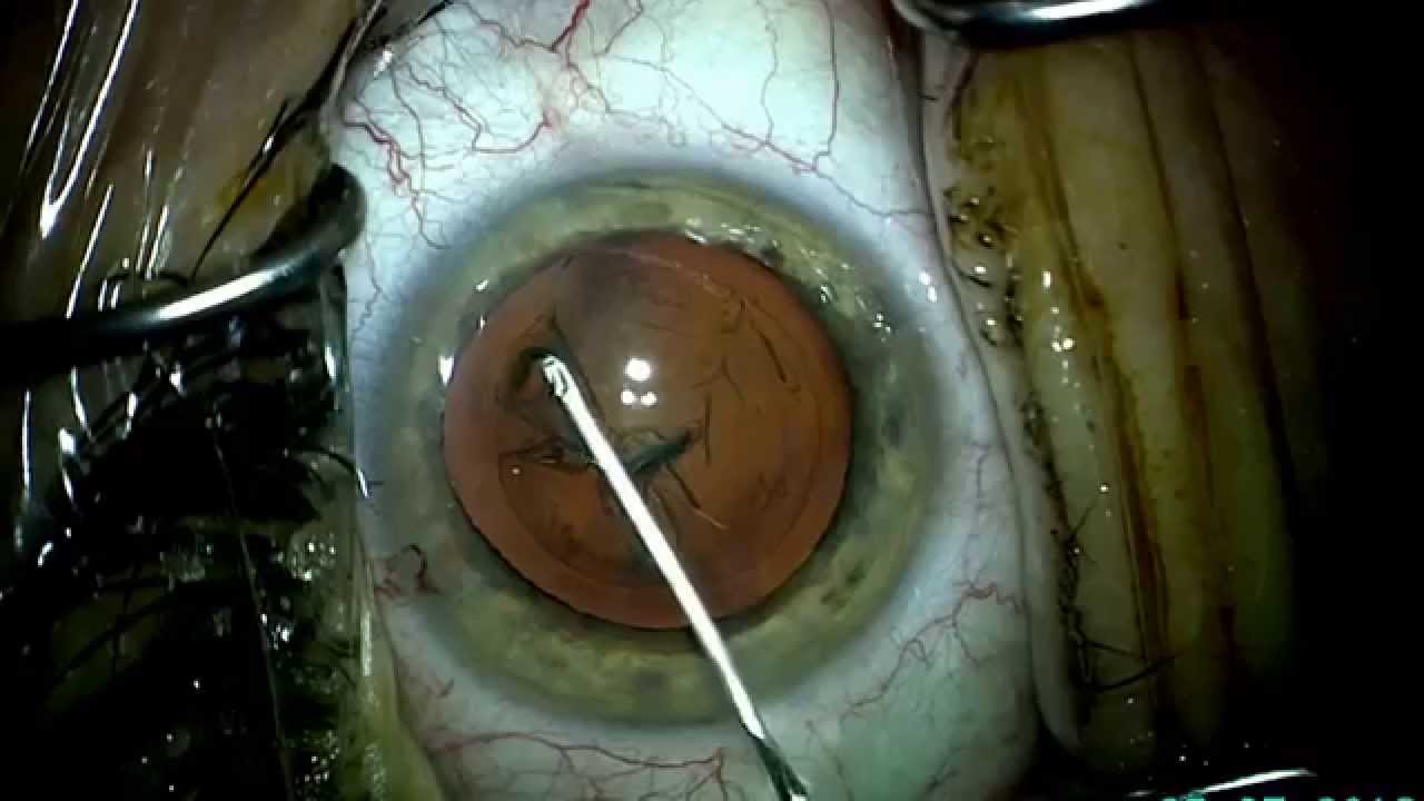 Rodolfo Benavides Villarreal-6