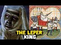 The Leper King - Baldwin IV of Jerusalem - Great Personalities - See U in History
