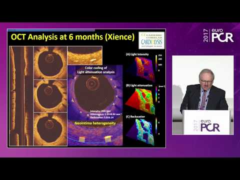 How a unique DES platform translates into clinical differentiation with MiStent - EuroPCR 2017