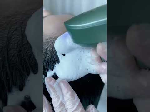 Troubled by scalp problems, specially come to wash immersive shampoo sleep aid #diy  #scalpcare