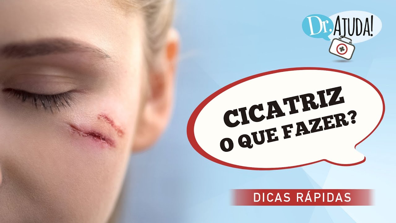 O QUE FAZER PARA DEIXAR CICATRIZ MENOS APARENTE