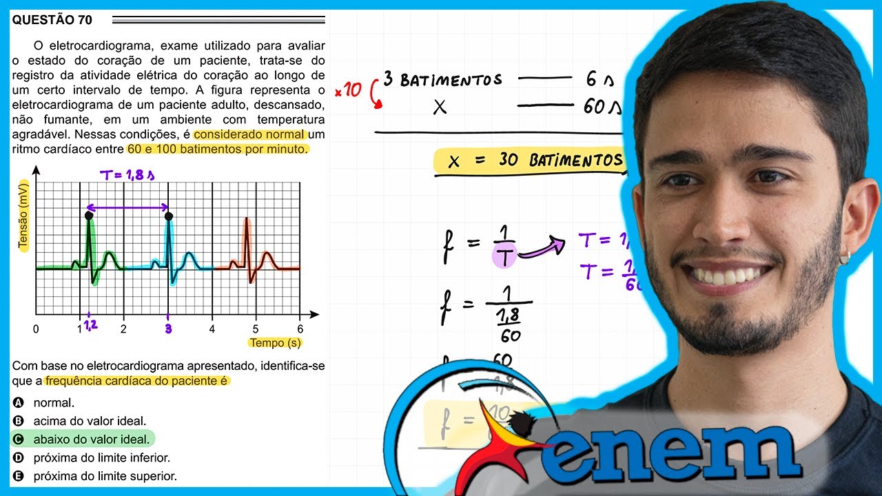 ENEM 2016 2ª aplicação - O eletrocardiograma, exame utilizado para avaliar o estado do coração de um