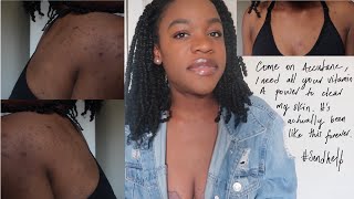 Cost For Accutane