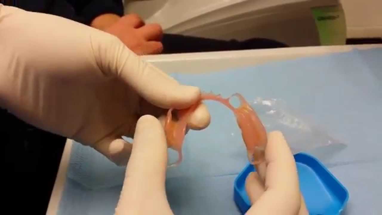 flexite protesi nylon estetiche e flessibili