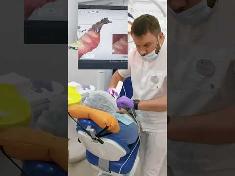 Цифровой 3D-сканер