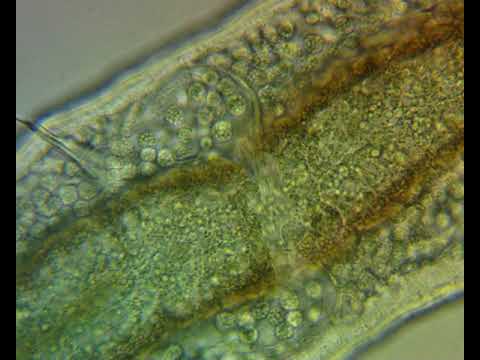 Detritus worm, part 3, 400x magnification