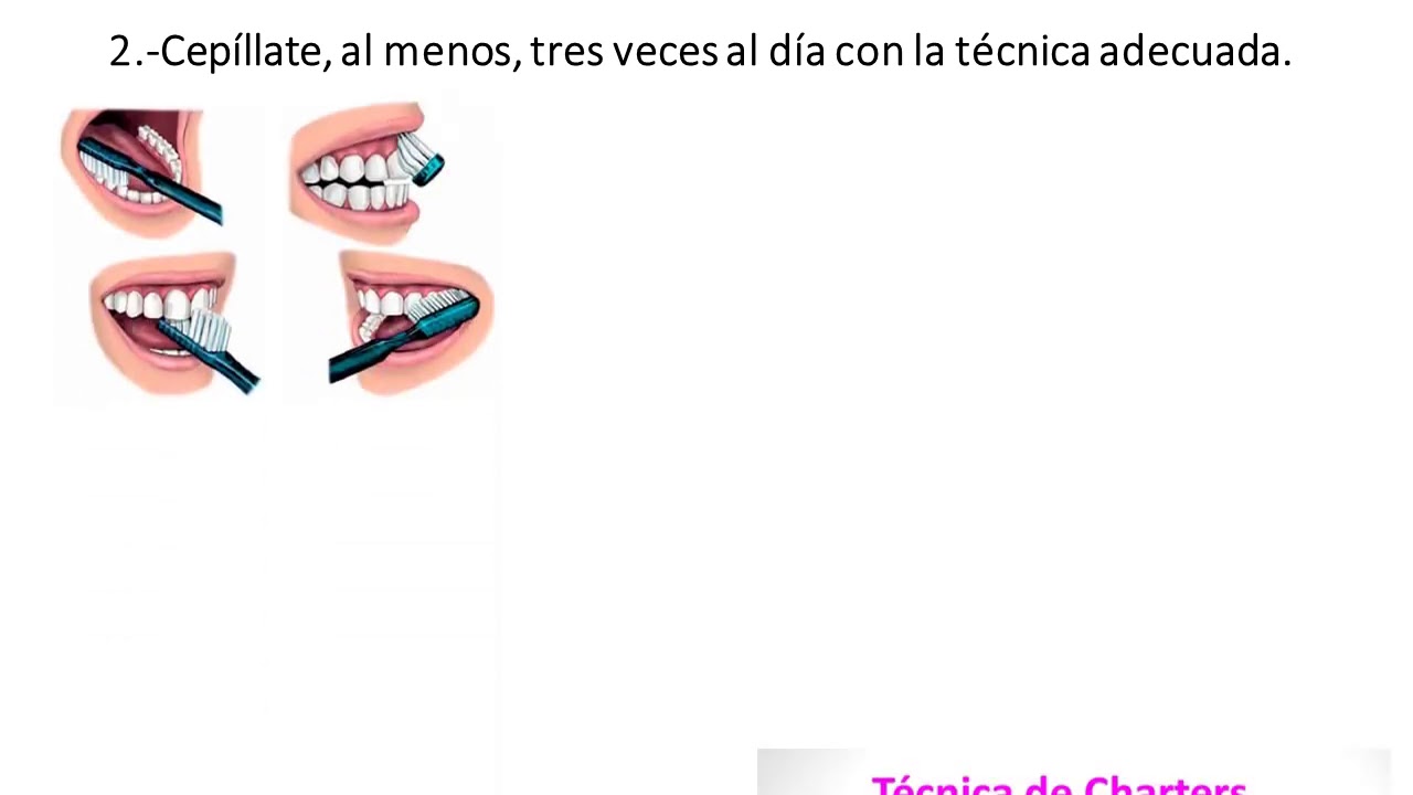 Enjuagues bucales con Cloruro de Cetilpiridinio para disminuir la carga viral coronavirus COVID-19
