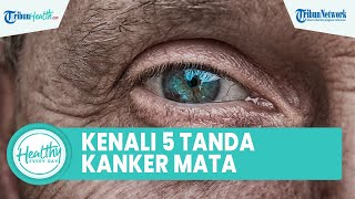 Inilah 5 Tanda Kanker Mata yang Perlu Diketahui: Hilangnya Penglihatan & Muncul Benjolan Kecil