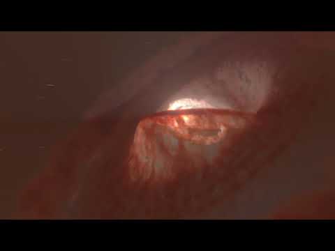 Artistic Animation of the Warped and Torn Apart Disc of GW Orionis