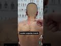Levator Scapulae Muscle Stretch For Neck Pain
