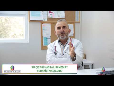 Su Çiçeği Hastalığı Nedir? Çocuk Sağlığı ve Hastalıkları Uzmanı Dr. Numan Kul