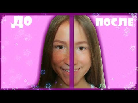Белая глина отбеливает кожу лица Отбеливающие маски для кожи от загара