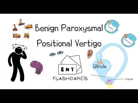 Benign Paroxysmal Positional Vertigo - FRCS ENT Exam Essentials