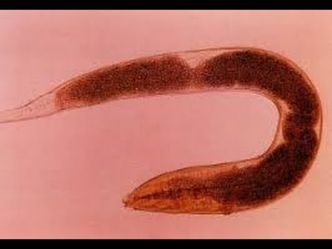 Pinworm észlelés