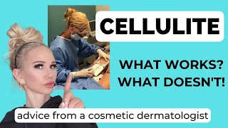 CELLULITE! Do at home treatments work How you can fix dimpled skin on your body