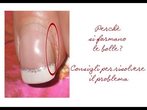 Dopo che la coagulazione laser male vede un occhio Maschera da miele per la persona da un peeling