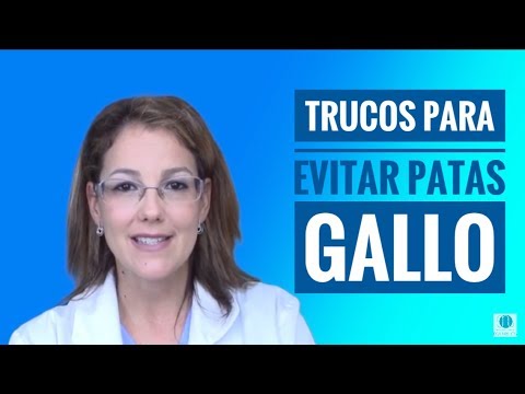 COMO PREVENIR APARICIÓN PATAS GALLO