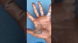 Skin peeling 😲‼️