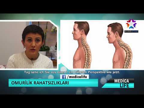 Keil Gelenke des Fingers Schwindel und Übelkeit Ursache für degenerative Bandscheibenerkrankungen der Halswirbelsäule
