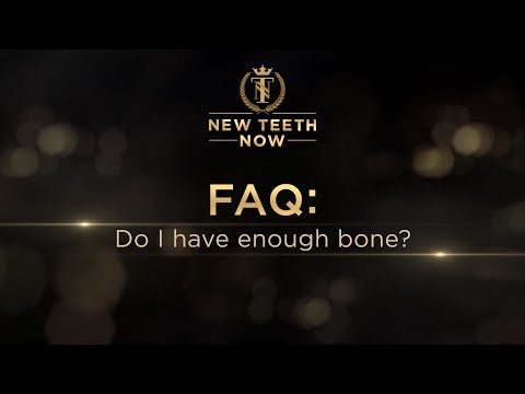 Bone Loss | Do I Have Enough Bone For Dental Implants?