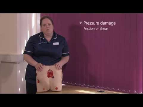 Pressure Ulcers